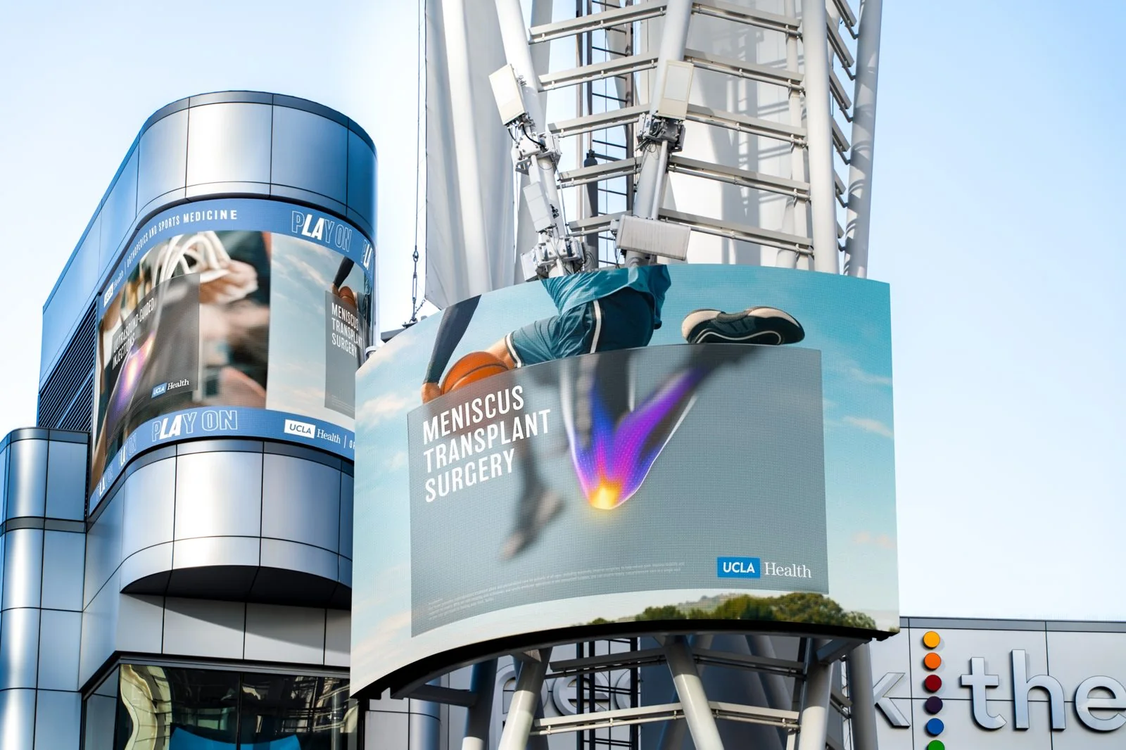 Curved digital screens at LA Live showing Meniscus transplant surgery and Ultrasound-guided injections